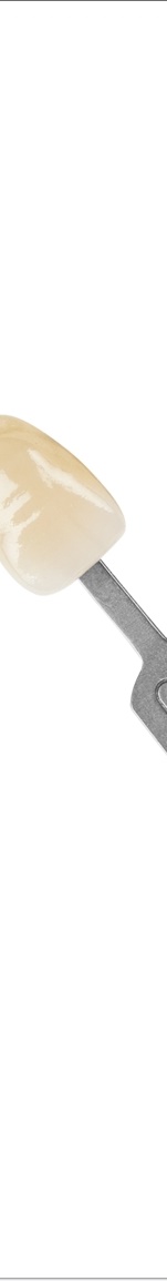 광화문치과 라미네이트 치료 전 고민해야 할 것 관련 이미지 4