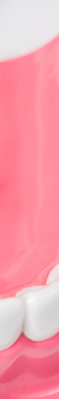 종각역치과 자연치아를 살리기 위한 대책, 신경치료 관련 이미지 24