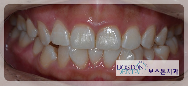 종각역치과추천 꼭 필요한 치료만! 관련 이미지 5