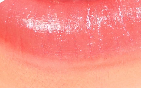 종로치과 치아미백 밝고 환하게 관련 이미지 23