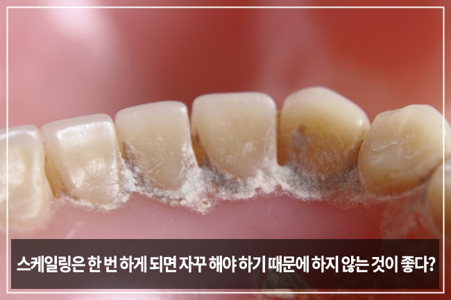 스케일링에 대한 잘못된 상식 관련 이미지 2