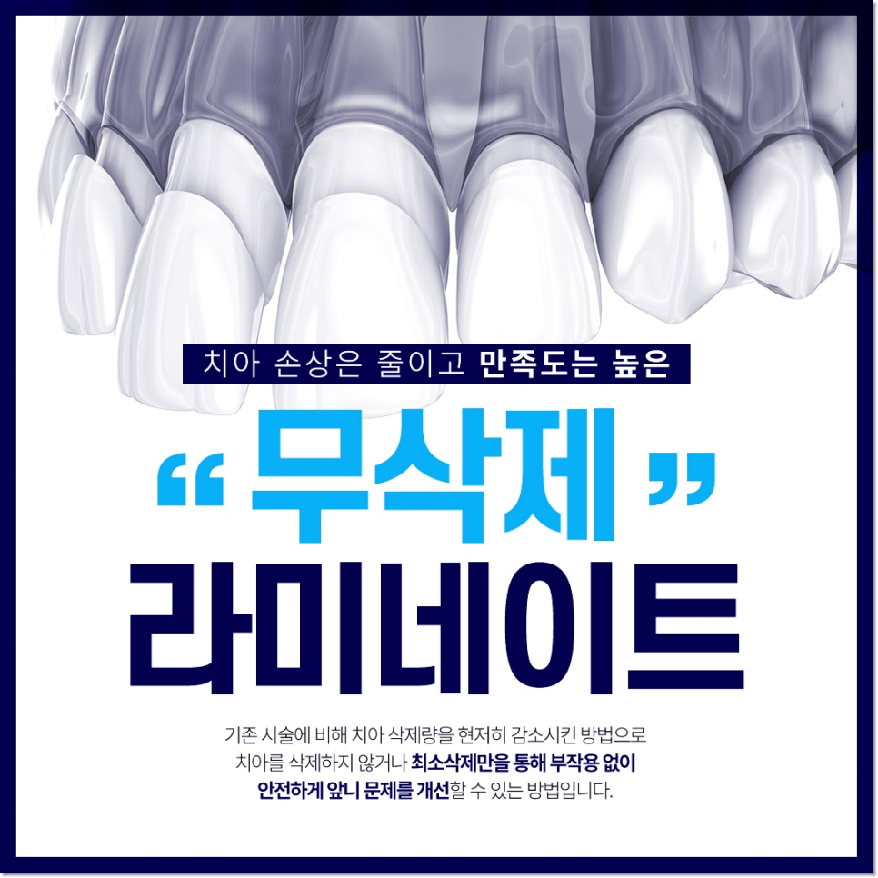 종각치과에서 알려드리는 치아미백과 라미네이트의 숨겨진 비밀 관련 이미지 7