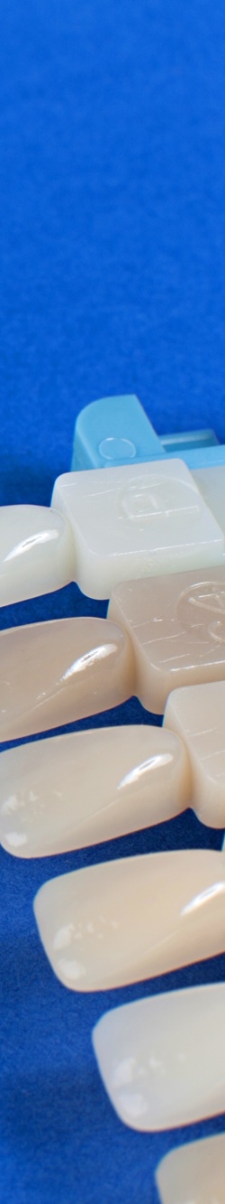 을지로입구역치과 치아미백으로 하얀 미소 찾기 관련 이미지 22