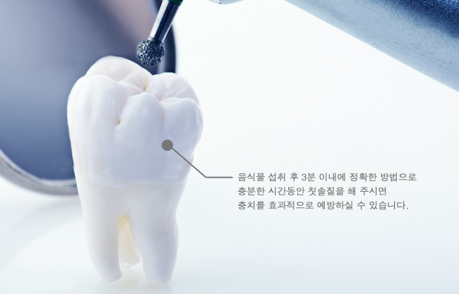 종각역 충치치료 꼼꼼하게~ 관련 이미지 6