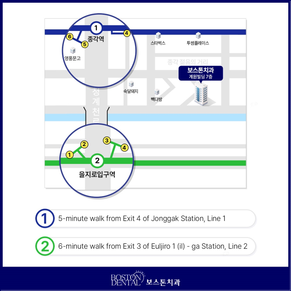 을지로입구역치과 치아 미백 전후 알아봐요! (Tooth whitening) 관련 이미지 9