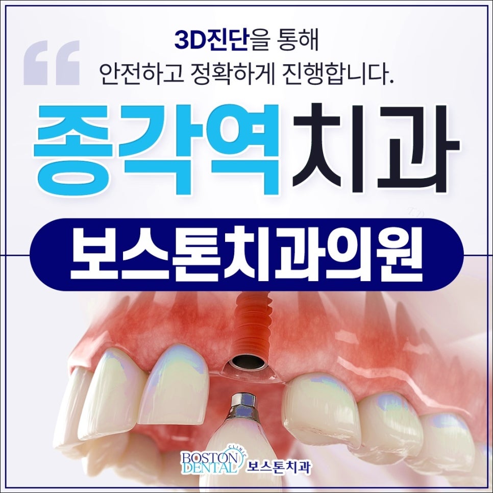 종각역 치과 임플란트 잘 마무리하기 위해서 관련 이미지 1