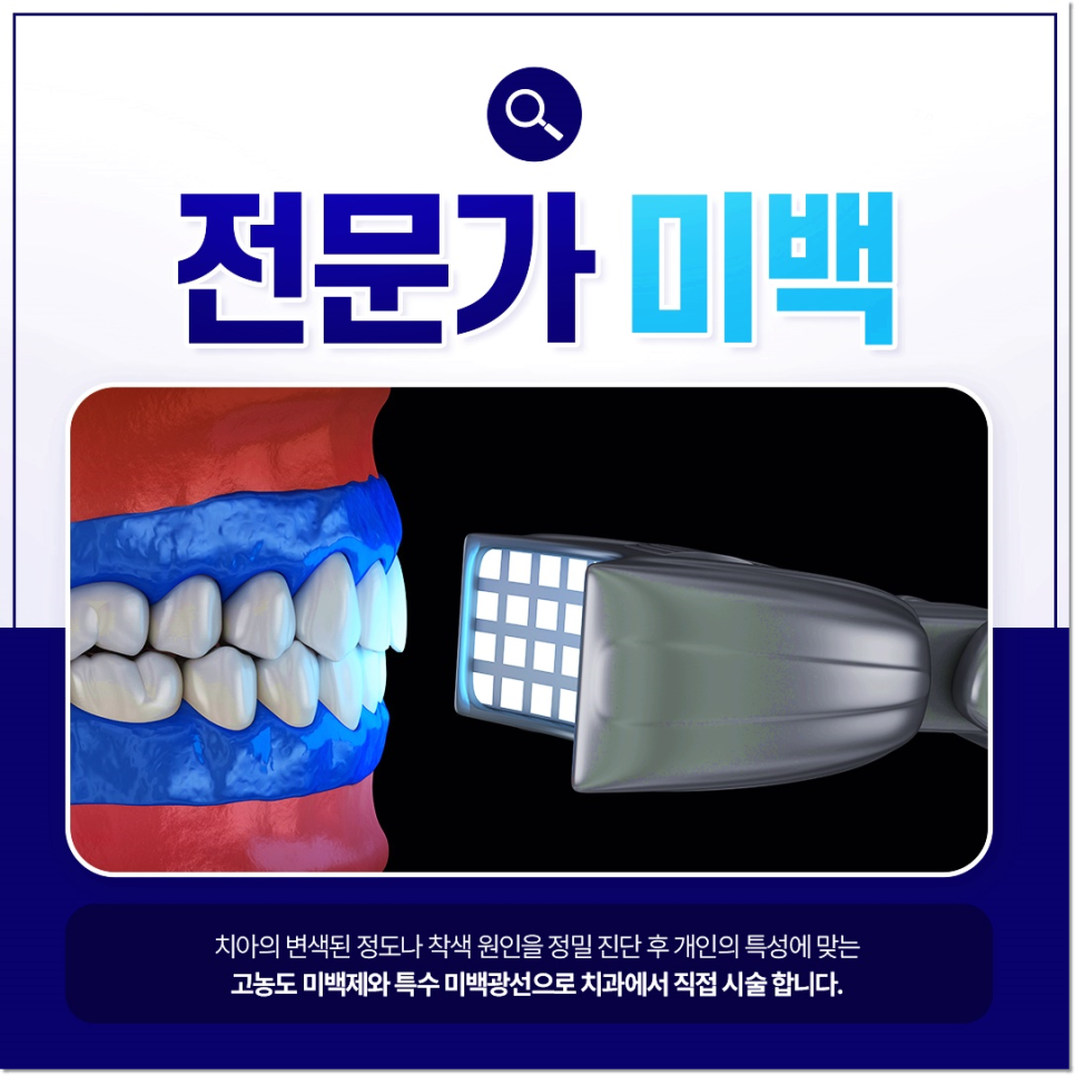 종각치과에서 알려드리는 치아미백과 라미네이트의 숨겨진 비밀 관련 이미지 4