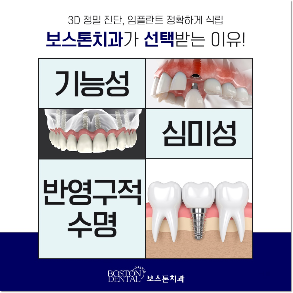 명동치과 상실부위는 임플란트로 관련 이미지 6