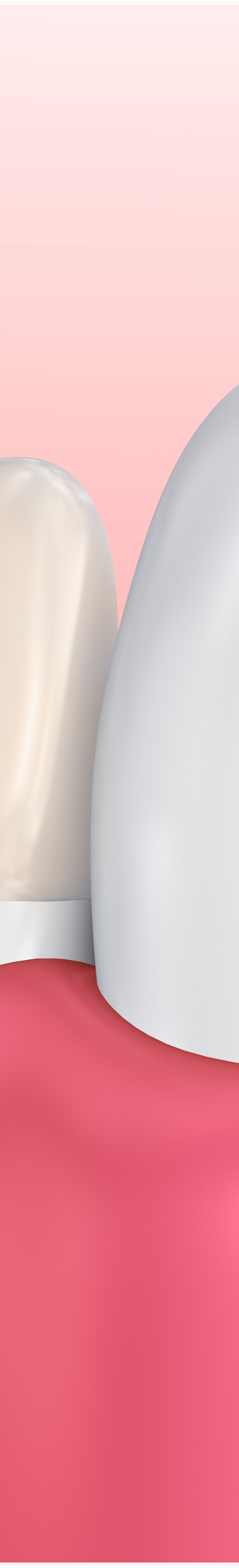 명동치과 라미네이트로 환하게 스마일~ 관련 이미지 24