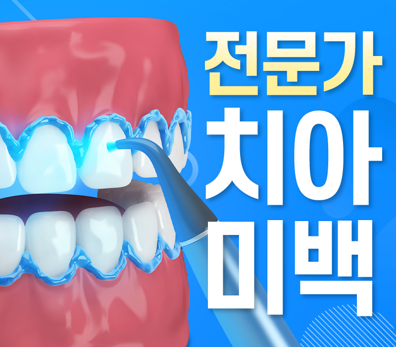 [종각역치과] 치아가 누렇게 보이는 진짜 이유, 미백 전에 꼭 알아야 할 것들 관련 이미지 1