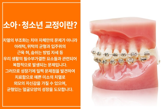 치아교정을 시작하기 좋은 나이는? 관련 이미지 5
