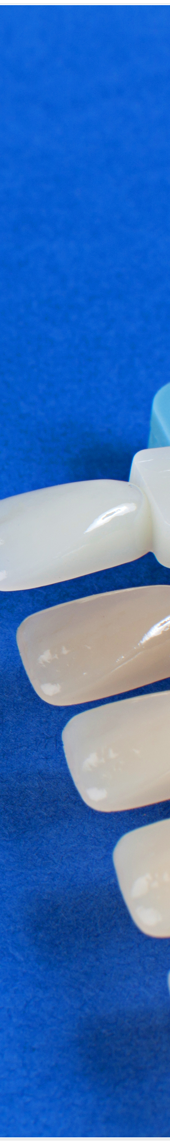 종로3가치과에서 알려드리는 무삭제 라미네이트 완벽 가이드 관련 이미지 26