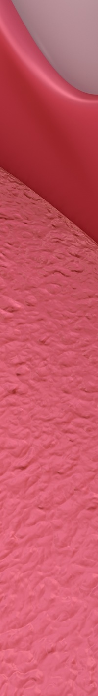 명동치과 주변 치아와 자연스러운 라미네이트 하는 방법 관련 이미지 22