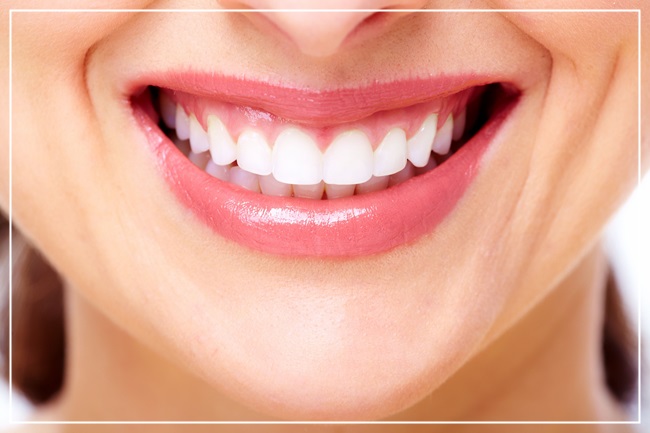 치아 변색 원인 1위, 홍차 관련 이미지 7