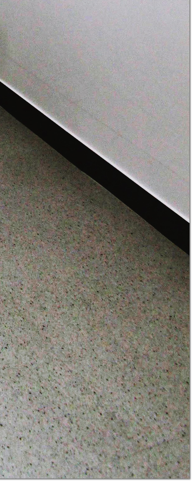 종각역치과 상실한 치아를 대체할 수 있는 방법 관련 이미지 27