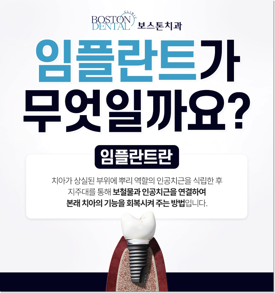 명동치과 임플란트에 대해 하나부터 열까지 관련 이미지 2