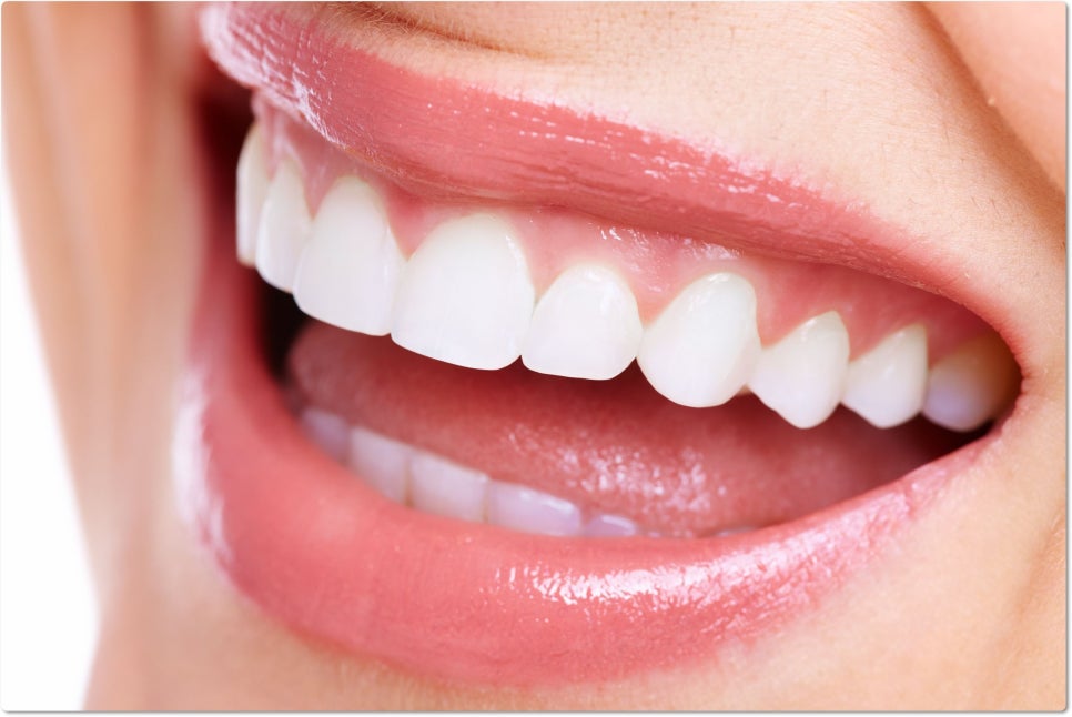 치아 건강에 영향을 미치는 흡연! 관련 이미지 5