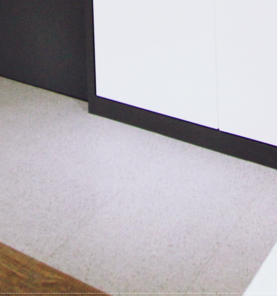 을지로치과 투명해서 티가 안 나게 교정할 수 있어요 관련 이미지 15