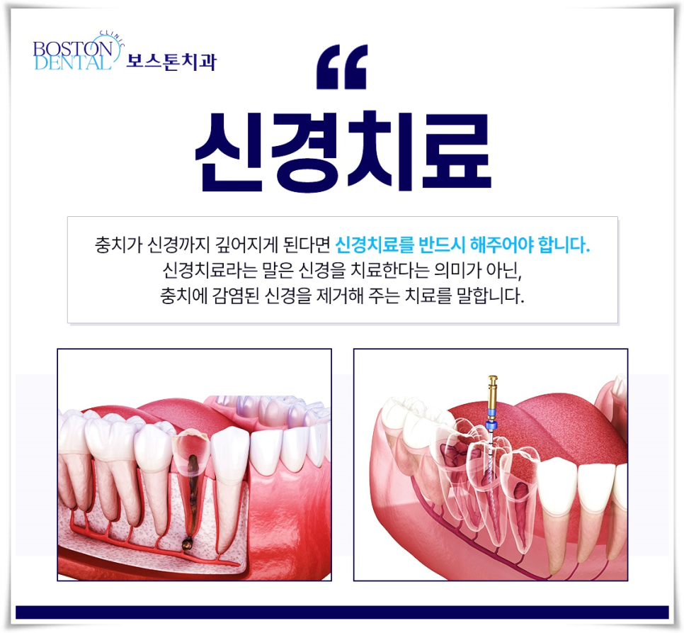 외국인치과 갑자기 치아가 아프다면? 관련 이미지 4