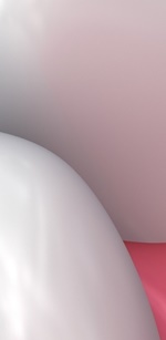 명동역치과 라미네이트 삭제된 치아는 다시 자라지 않습니다. 관련 이미지 30