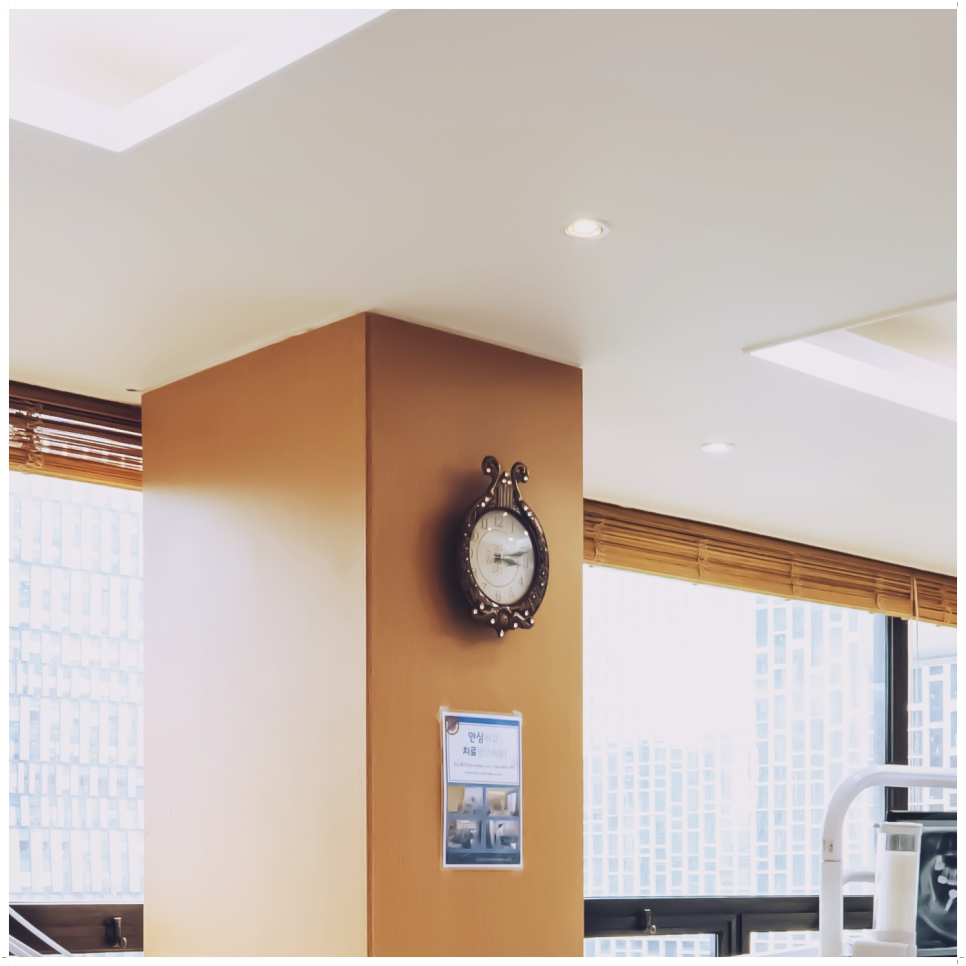 종로치과 마무리까지 확실하게 관련 이미지 24