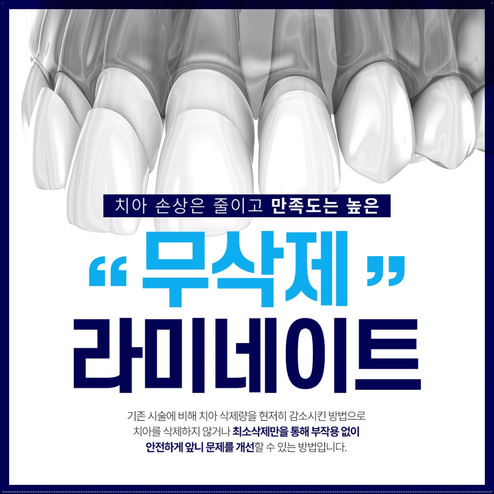 종각치과에서 알려드리는 치아미백과 라미네이트 이후의 달라진 일상 관련 이미지 6