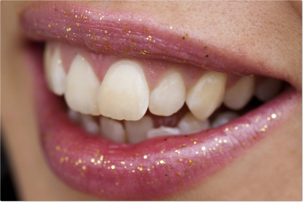 잇몸관리 제대로 하기 위해서는? 관련 이미지 4