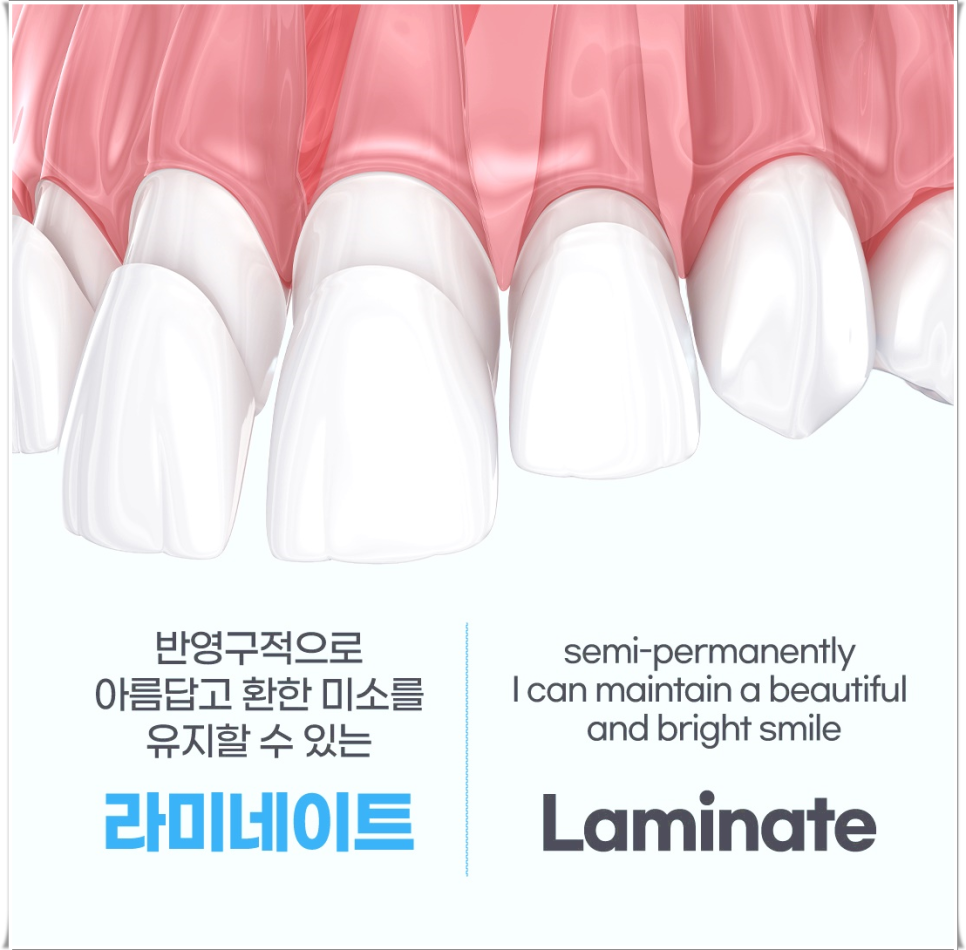 을지로입구역치과에서 알려드리는 치아미백과 라미네이트의 모든 것 관련 이미지 6