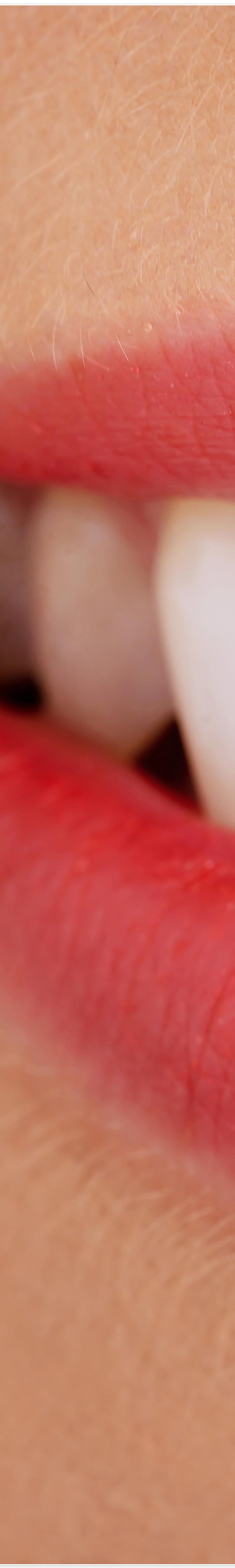 종로3가치과에서 알려드리는 무삭제 라미네이트 완벽 가이드 관련 이미지 11