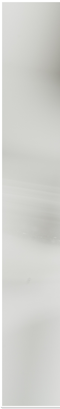 광화문역치과 치아미백과 라미네이트 나에게 필요한 건? 관련 이미지 25