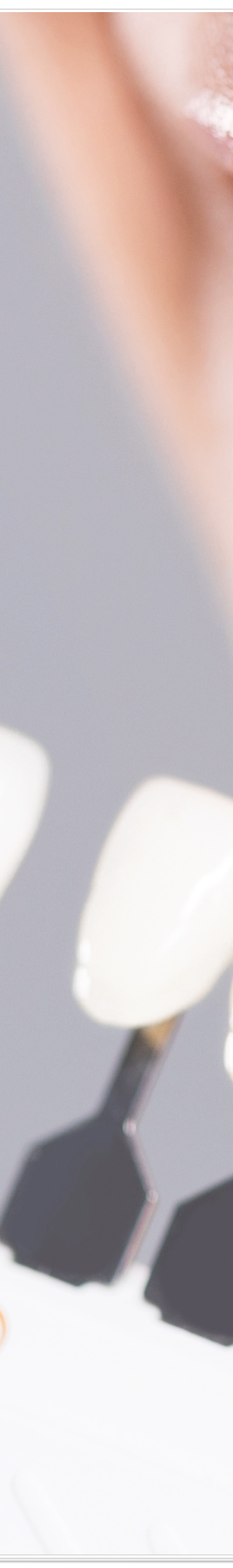 종로치과에서 알려드리는 치아미백과 라미네이트의 모든 것 관련 이미지 33