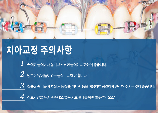 청계천치과 치아교정 안심하고 시작! 관련 이미지 6