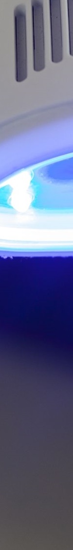 종로치과치료 커피&middot;와인 좋아해도 가능한 미백 유지 루틴 관련 이미지 23