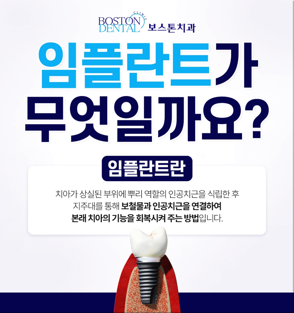 을지로치과 임플란트, 치아가 빠졌다면 어떻게 해야 할까요? 관련 이미지 2