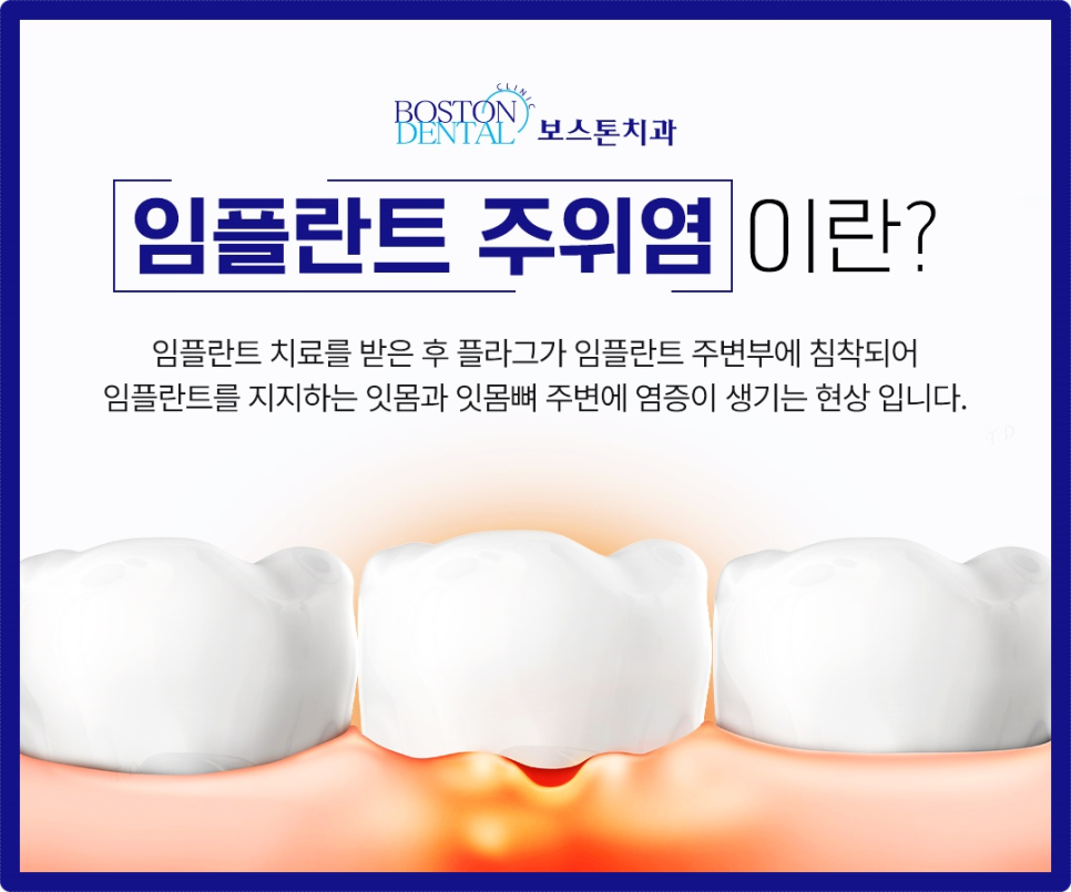 종로치과 바빠서 내원할 시간이 없으신가요? 관련 이미지 7