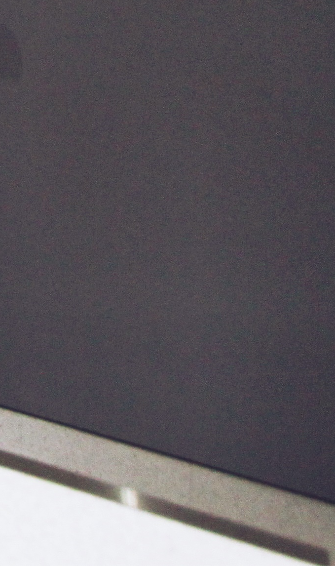 종로임플란트 이제는 걱정 말고 편안하게 관련 이미지 12