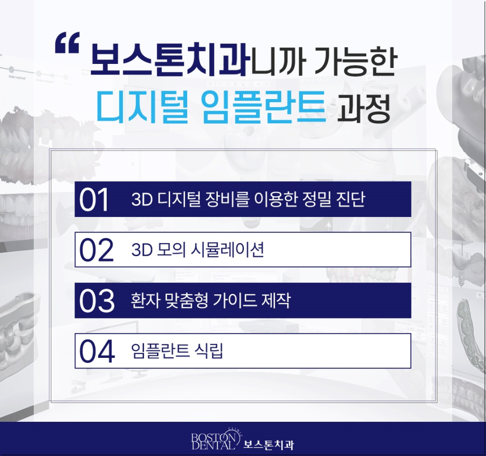 명동치과 임플란트 하기 전 알아두면 좋은 정보 관련 이미지 5
