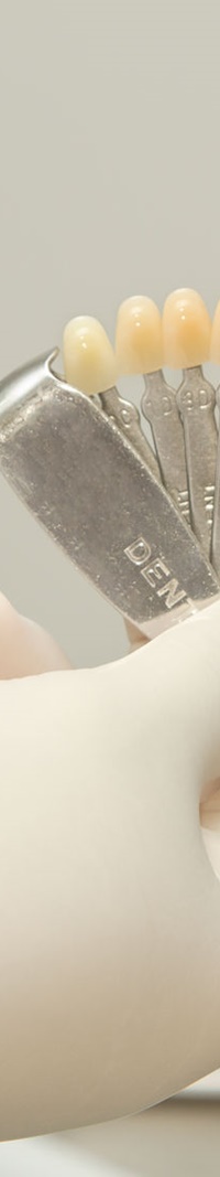 을지로입구역치과 치아미백으로 하얀 미소 찾기 관련 이미지 11