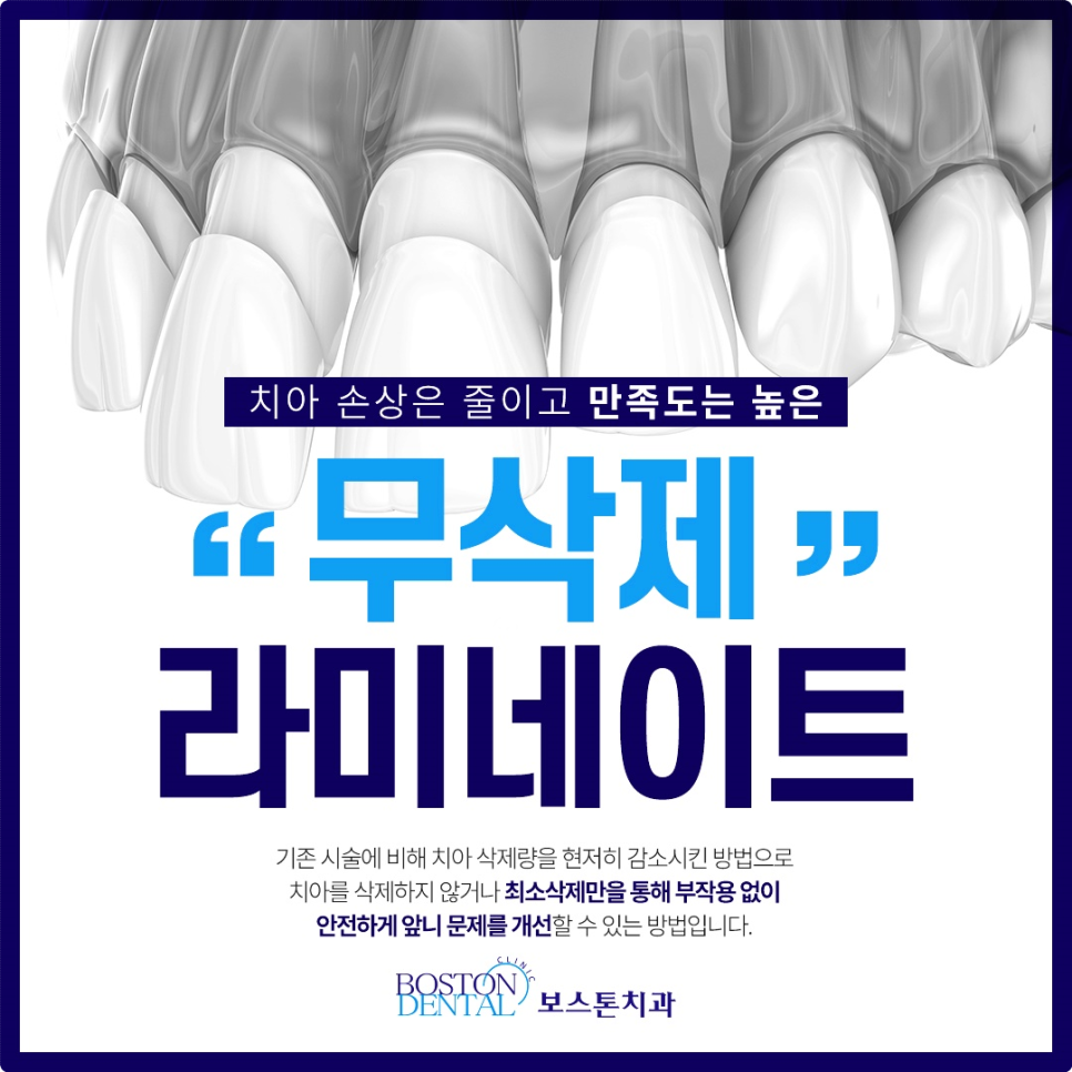 명동치과 라미네이트로 환하게 스마일~ 관련 이미지 5