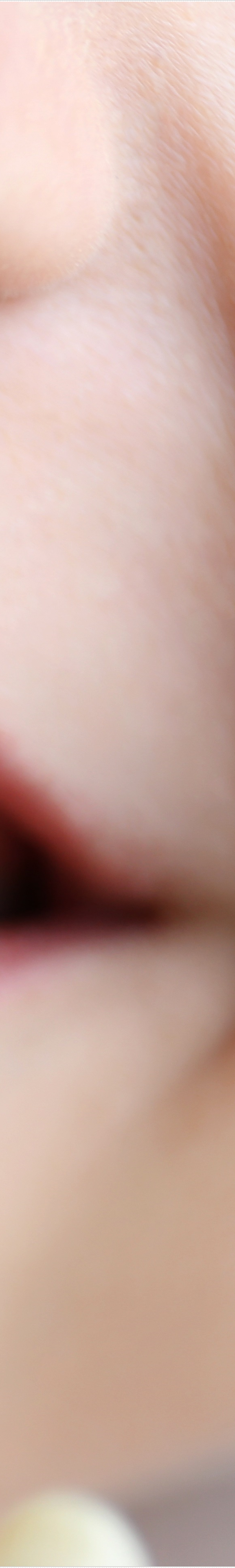 을지로입구역치과에서 알려드리는 치아미백과 라미네이트의 모든 것 관련 이미지 25