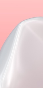 명동역치과 라미네이트 삭제된 치아는 다시 자라지 않습니다. 관련 이미지 20