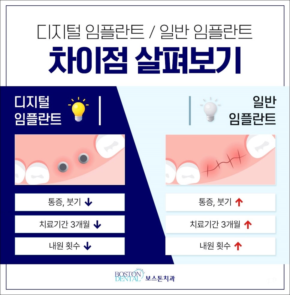 종각역 치과 임플란트 잘 마무리하기 위해서 관련 이미지 6