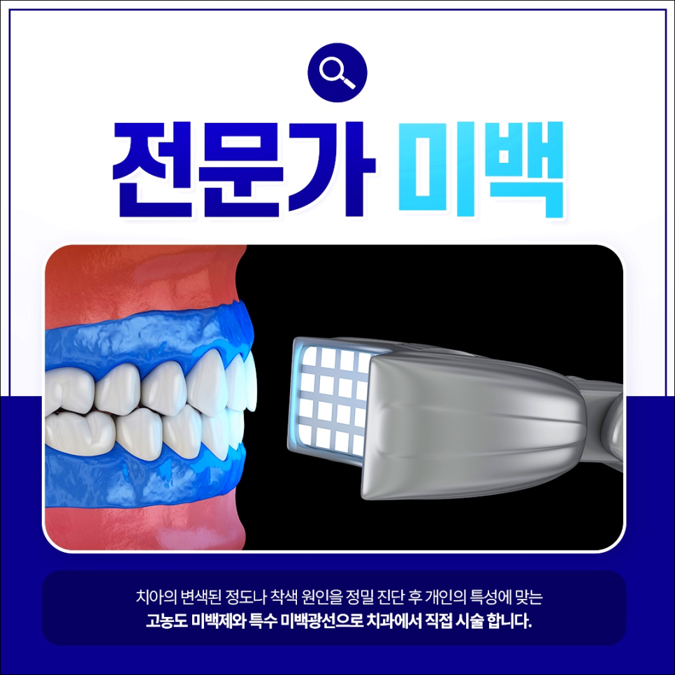 명동치과에서 알아보는 치아미백의 모든 것 관련 이미지 5