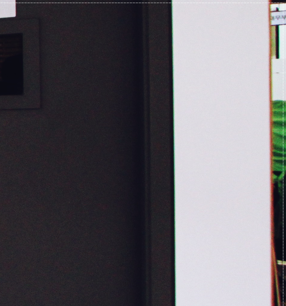 을지로치과 투명해서 티가 안 나게 교정할 수 있어요 관련 이미지 17