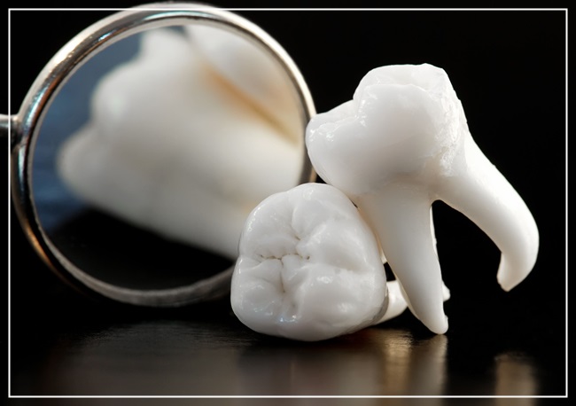 충치는 유전적인 질환?! 관련 이미지 3