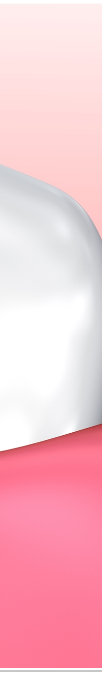 광화문역치과 치아미백과 라미네이트 나에게 필요한 건? 관련 이미지 12