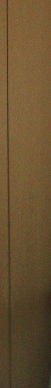 명동역치과 일상생활 중 치아가 흔들린다면 관련 이미지 16