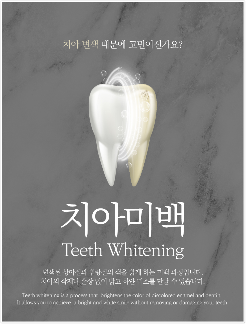 종각치과의 치아미백으로 하얀 미소 찾기 관련 이미지 9