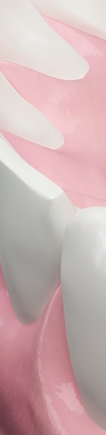 종로치과추천 나이별 &middot; 상황별 임플란트 치료 방법 관련 이미지 32