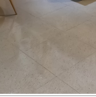 종각치과의 치아미백으로 하얀 미소 찾기 관련 이미지 33